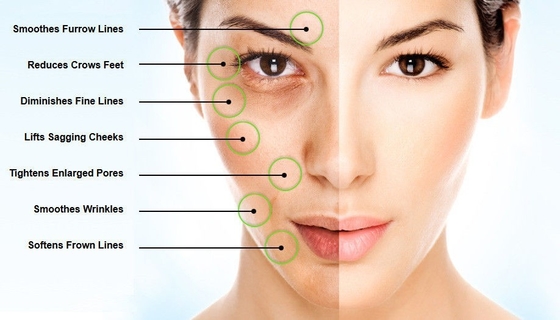 Polvo ácido hialurónico del EINECS 232-678-0 polvo de 2000 - de 5000 Dalton Pure Hyaluronic Acid Serum